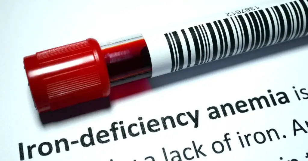 iron deficiency can be a low histamine diet side effect