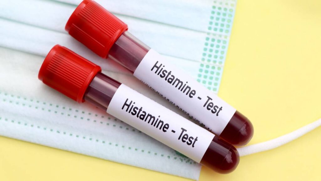 testing for histamine intolerance