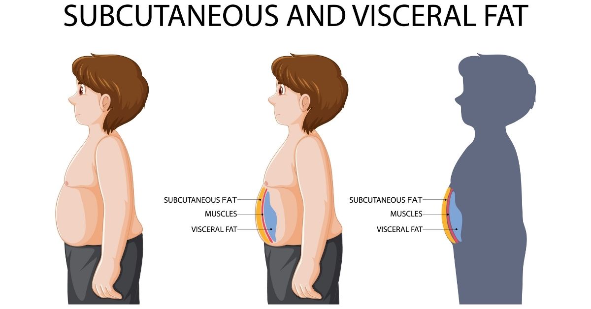 visceral fat and histamine intolerance
